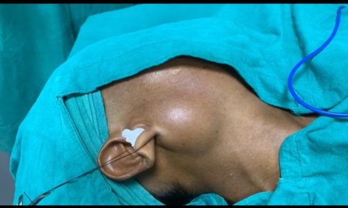 HEAD AND NECK TUMOR COVER PHOTO (1)