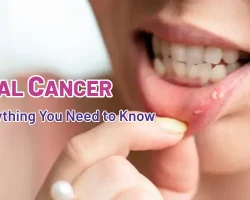Oral-Cancer-1
